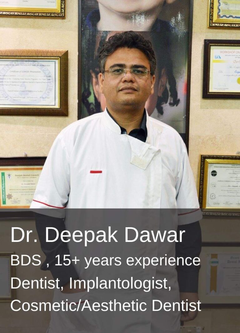 Root Canal Treatment Doctor Dawar